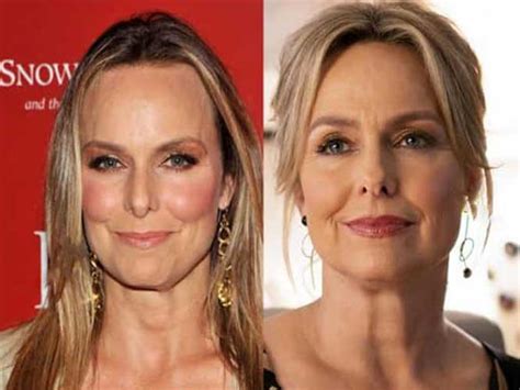 melora hardin breast|The Office Star Melora Hardins Iconic Plastic Surgery Was ...